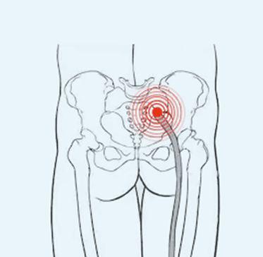 Elite Pain & Health